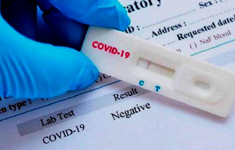 Positivas más del 16% de las pruebas de detección de COVID en Módulos del GEM