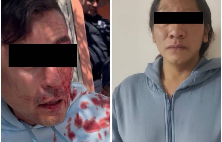 Rescata policía de Ecatepec a bebé que fue golpeado por su padre