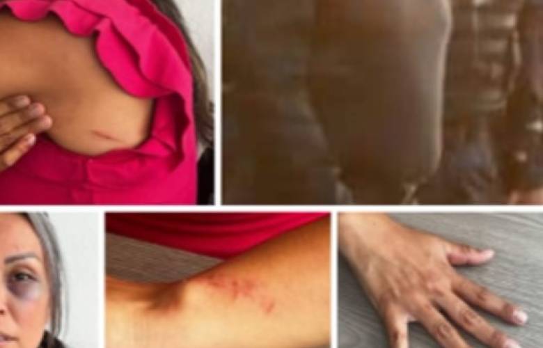 Investigan la Secretaría de Seguridad a presunto polícia golpeador