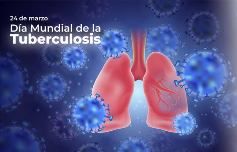 Aún pendiente vacuna contra la tuberculosis pulmonar 