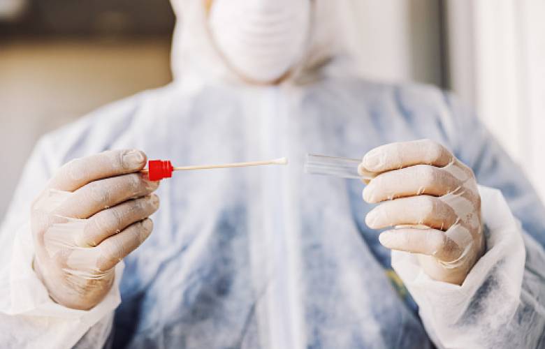 Se aplicarán pruebas rápidas en Unidades Hospitalarias destinadas para atención de Covid-19