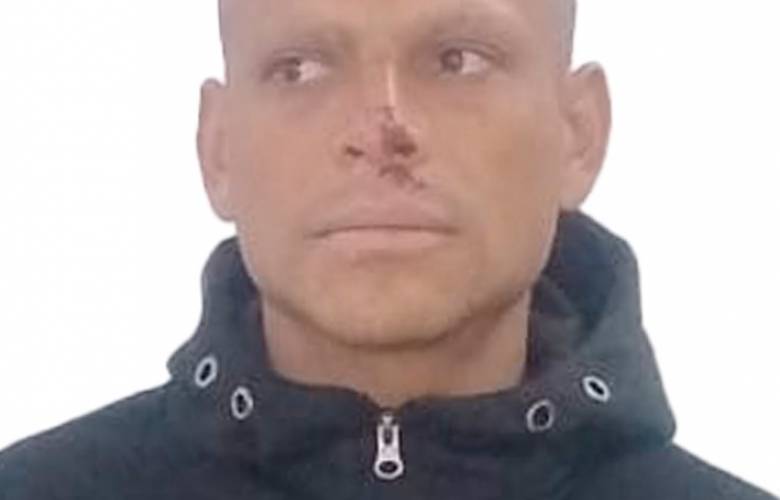 Sentencian a 26 años y 4 meses a sujeto por feminicidio en grado de tentativa, en agravio de su pareja sentimental y su suegra 